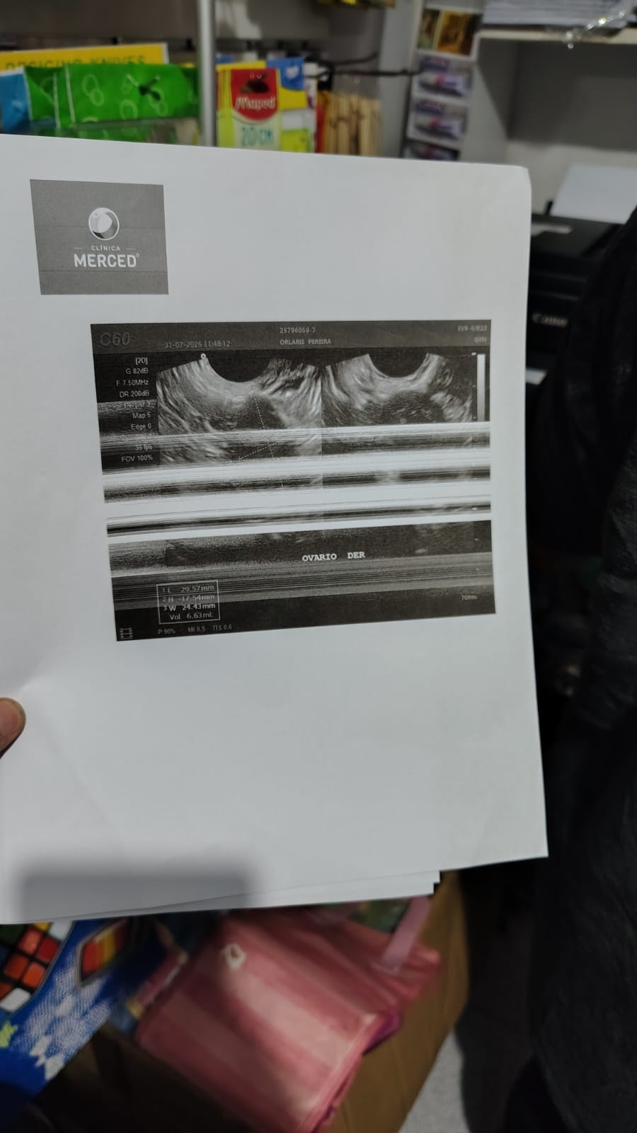 Cabezal obstruido